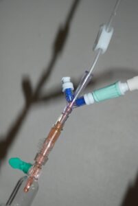 Dispositif d'injection des médicaments de chimiothérapie