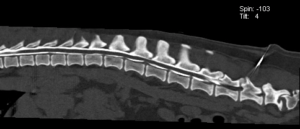 Myélo scanner, reconstruction en coupe sagittale