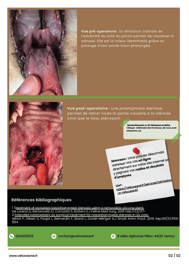 Partage 1 page 2 Sténose pharyngée