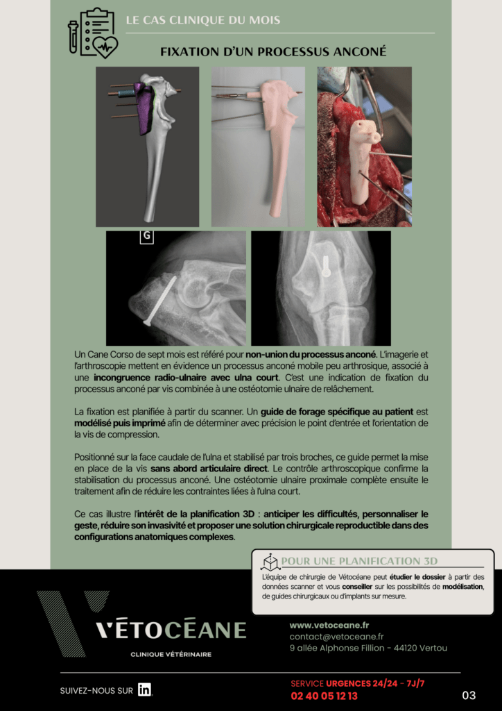 Partage 11 page 3 L'impression 3D