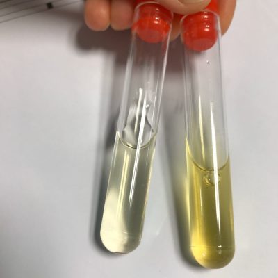 Tubes analyse d'urine